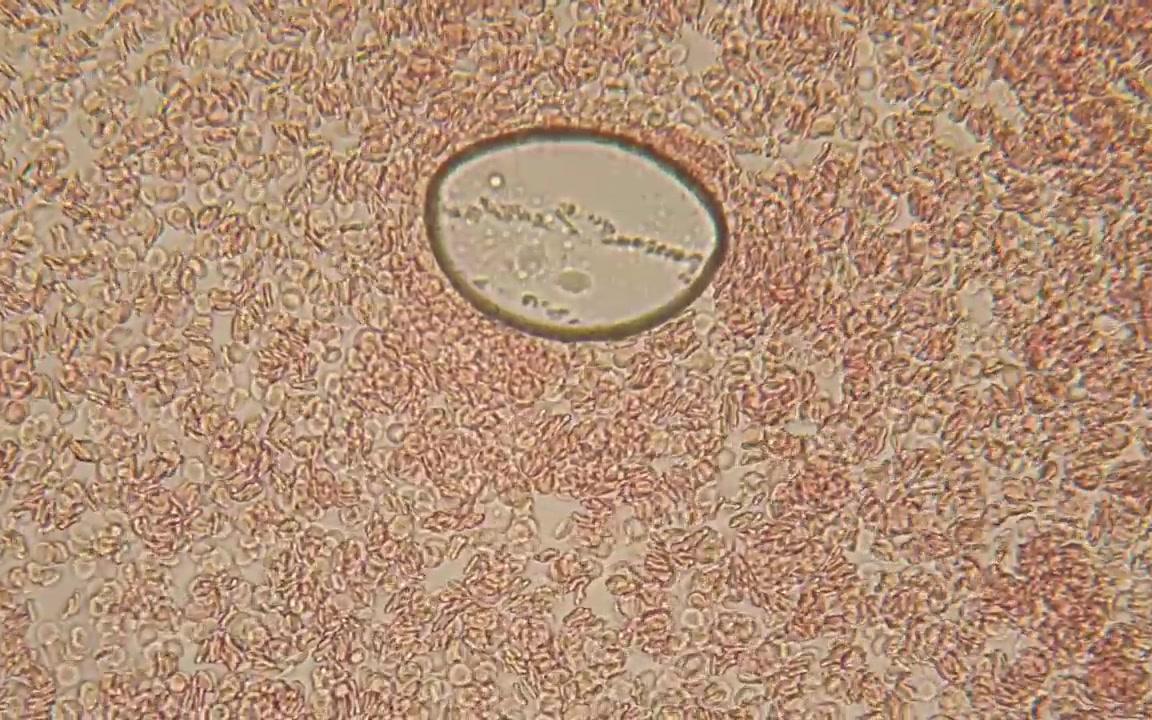 显微镜下的血液形态