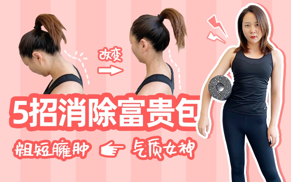 告别圆肩驼背5个动作消除富贵包