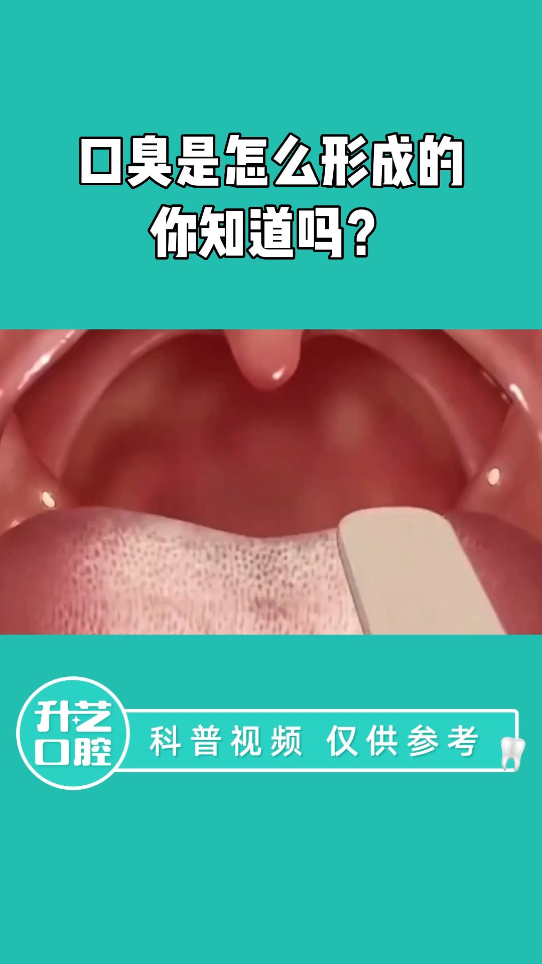 口臭是怎么形成的你知道吗?哔哩哔哩bilibili