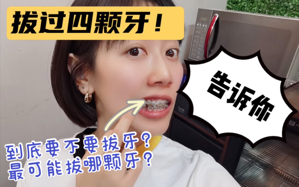 正畸分享 | 为了美拔掉四颗牙:矫正最可能拔掉哪颗牙?哔哩哔哩bilibili