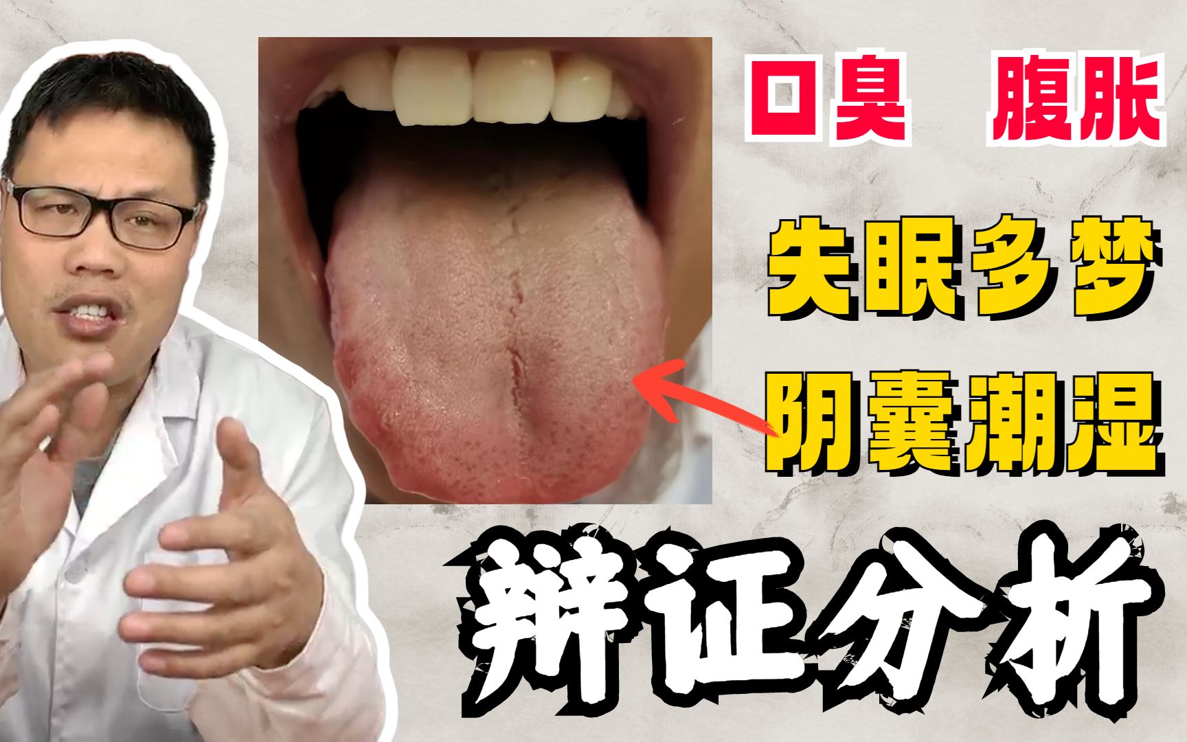 什么是阴囊湿疹_刘文斌医生视频讲解皮肤科疾病-快速问医生