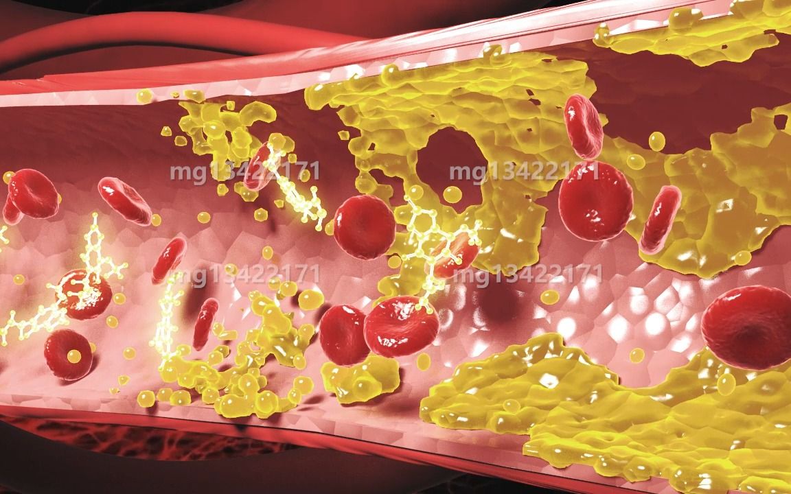 水蛭素 血栓溶解红细胞