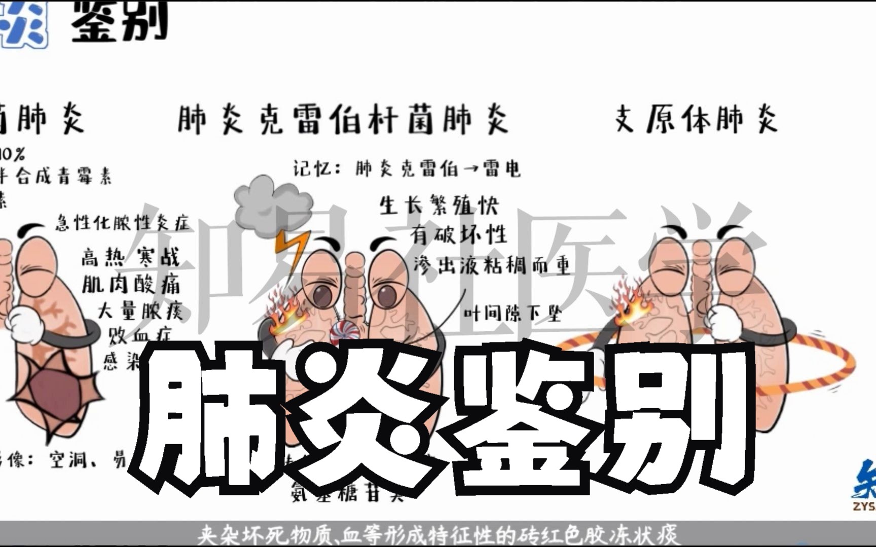 医学手绘演绎 各种肺炎鉴别哔哩哔哩bilibili