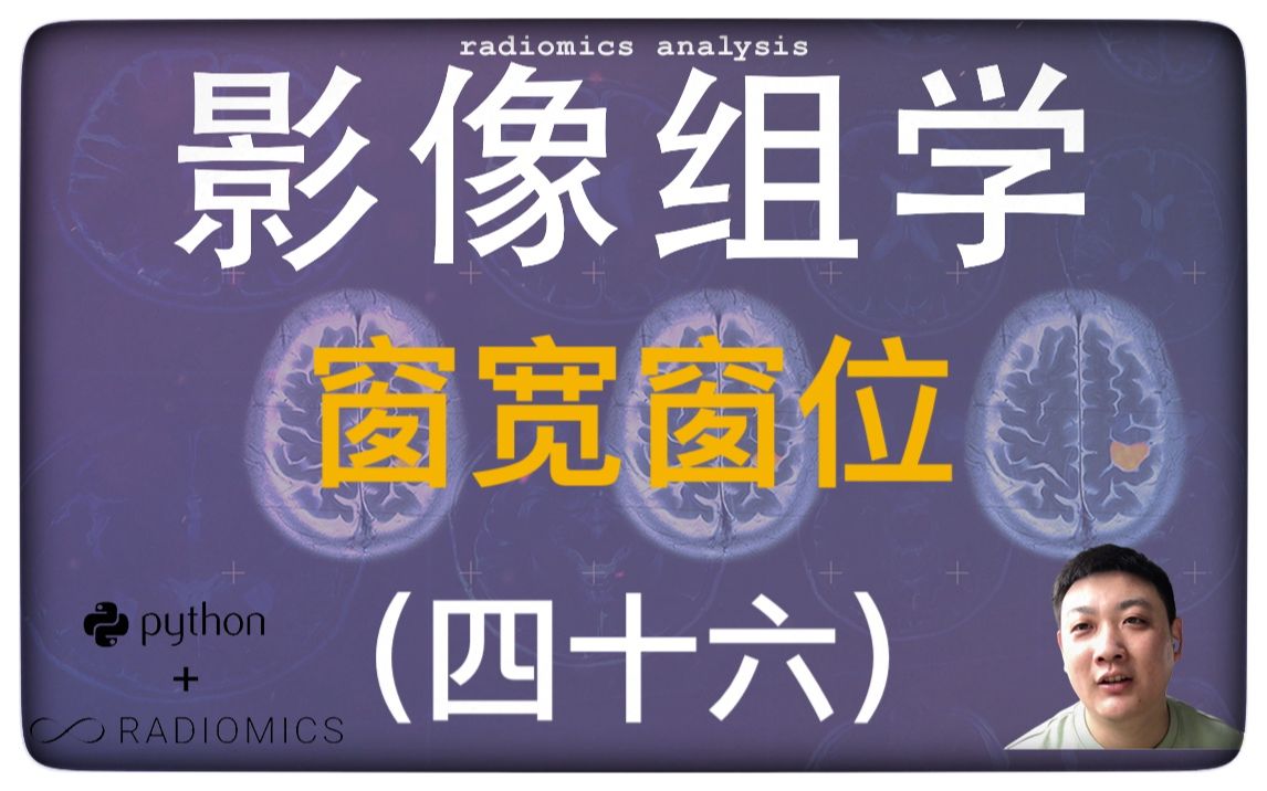 影像组学更新 | 影像组学要设置窗宽窗位吗?你看到的未必是真的!哔哩哔哩bilibili