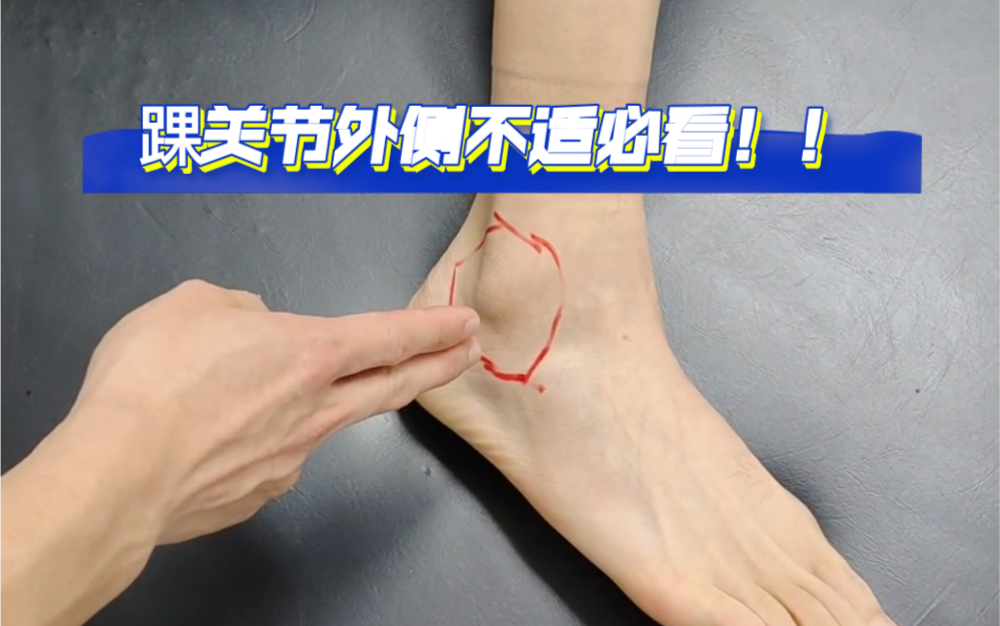 踝关节外侧疼痛不适?手法快速缓解,快来试一试!