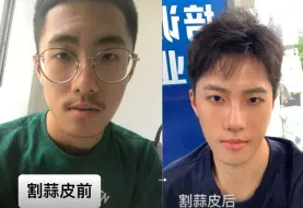 下载视频: 割了吧，会变帅的