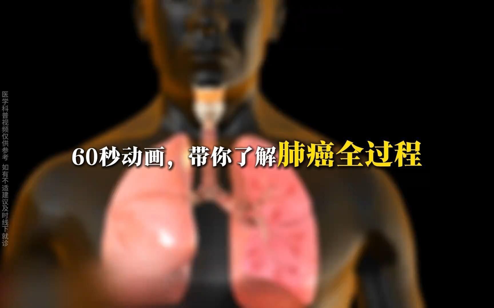 肺癌的发展过程