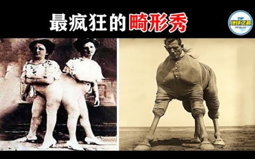 [图]100年前的“畸形秀”有多疯狂？12个历史上真实存在的怪胎，揭秘马戏背后的无奈人生！丨地球之最