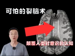 Download Video: 如果切断你大脑之间的连接会怎么样？