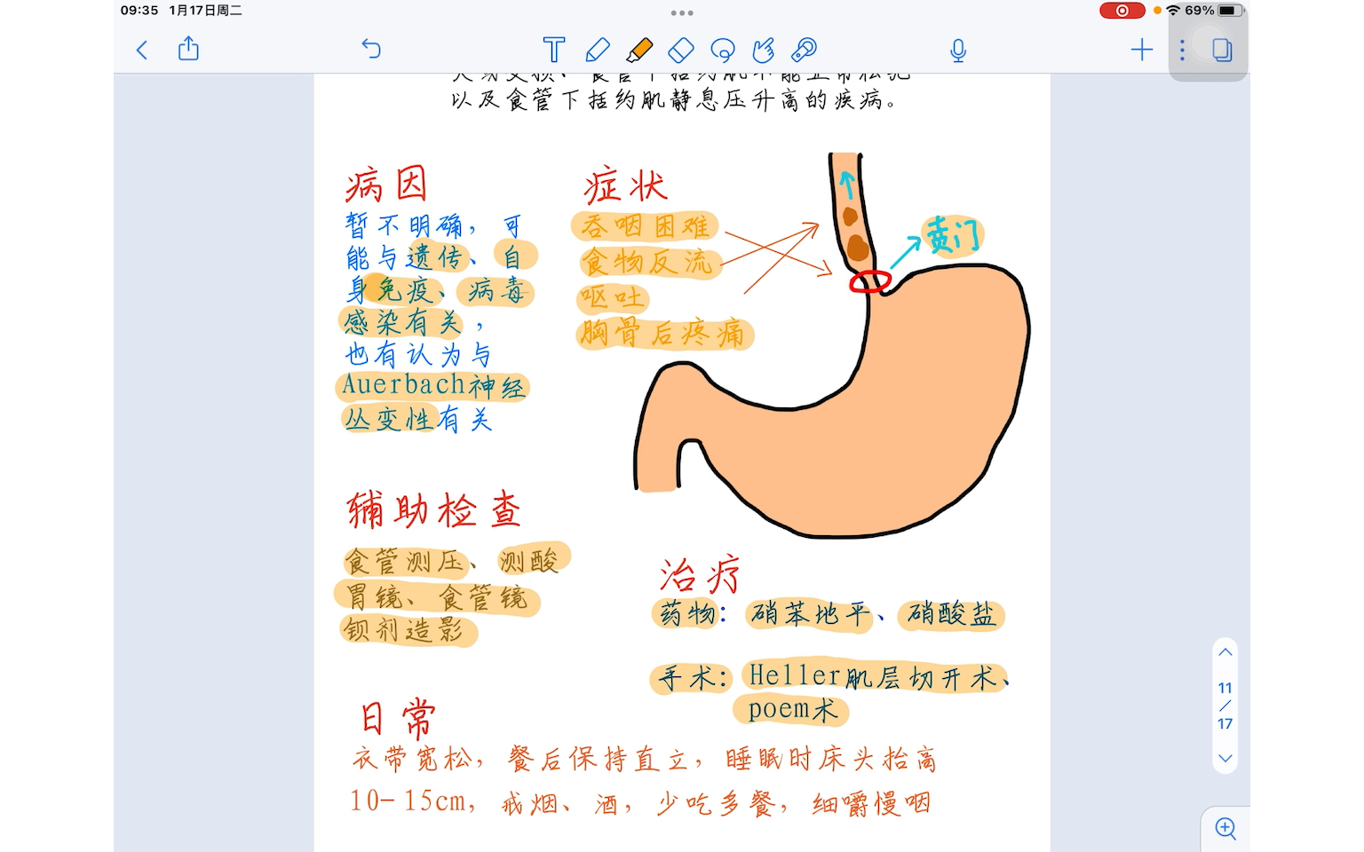 贲门失弛缓症
