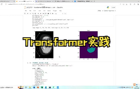 transformer实践(翻译、图片分类、目标检测、时间序列预测、图像分割)哔哩哔哩bilibili