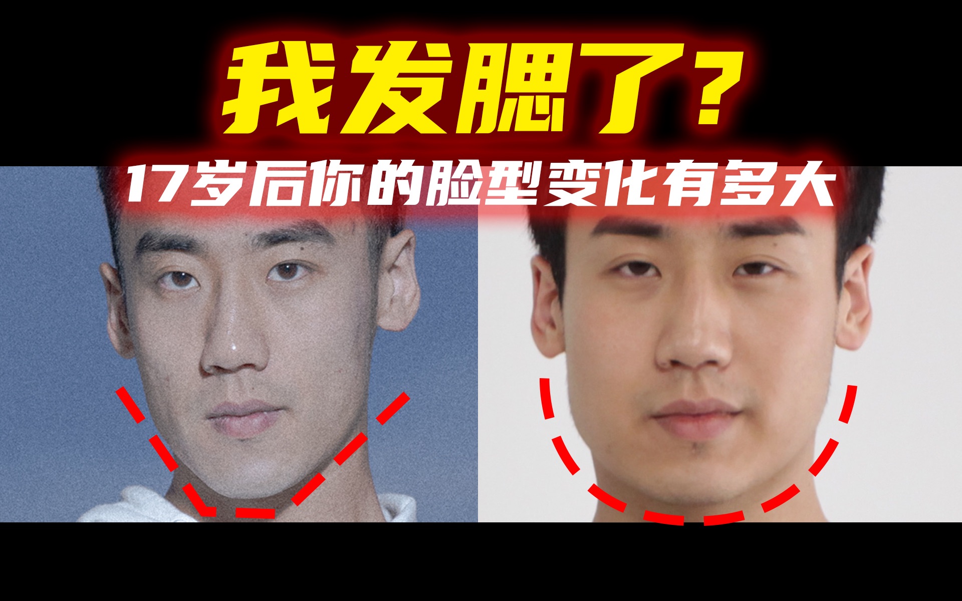 男人发腮前后对比图片