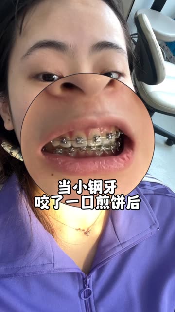 当一口小钢牙,咬了一口煎饼后