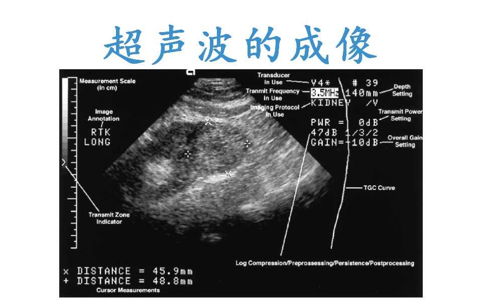 【医学成像100】28. 超声波的成像*美国医学物理师*西安电子科技大学哔哩哔哩bilibili