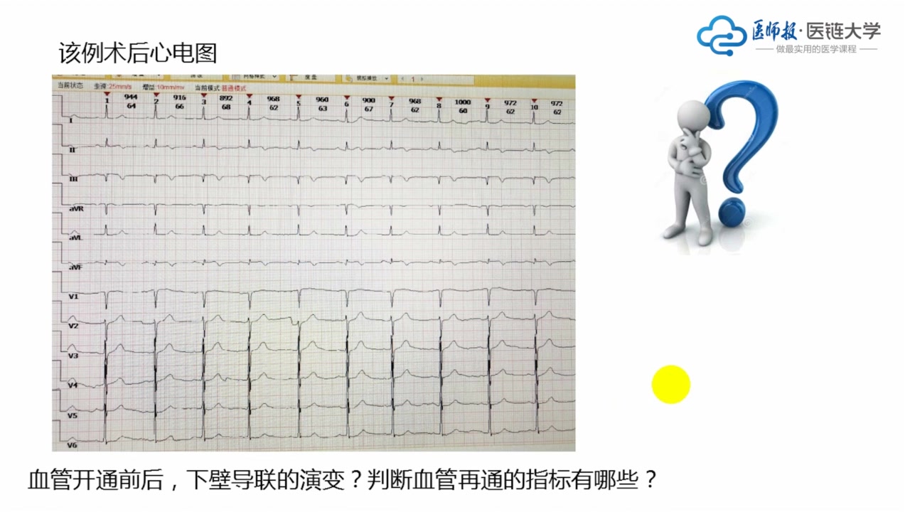 [图]【内科规培】心电图合集