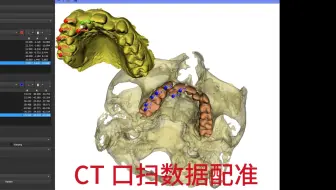 3D Slicer 口腔CBCT 分割 及 口扫数据配准