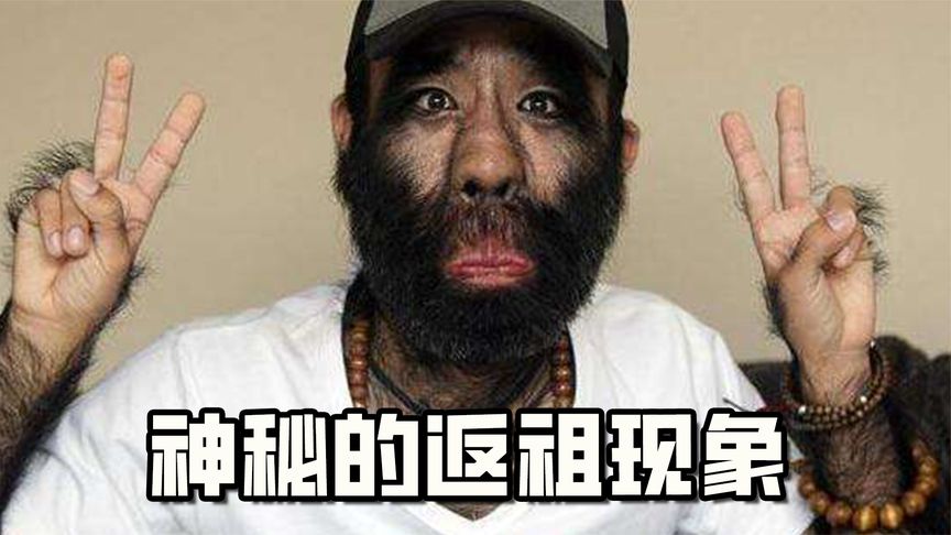 神秘的返祖现象:长尾巴的人类小孩,4条腿的海豚你见过吗?