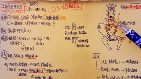 护理考研风湿系统4风湿热&强直性脊柱炎&痛风哔哩哔哩bilibili