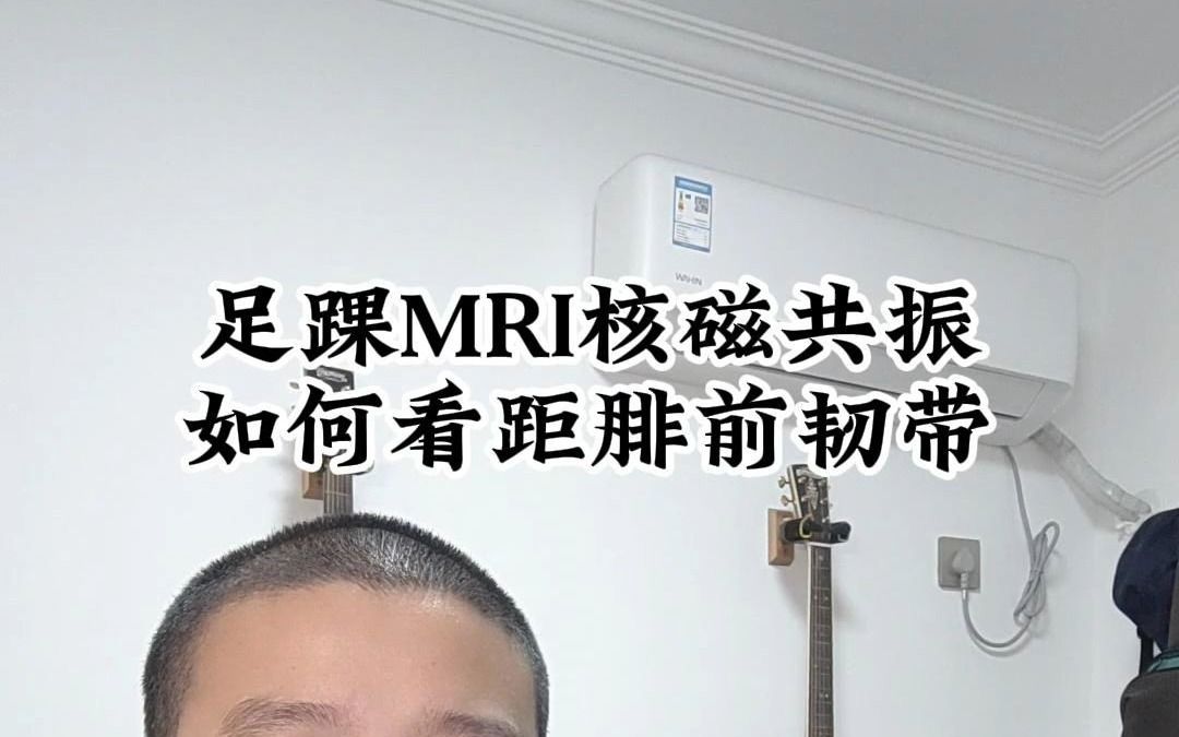 足踝MRI核磁共振如何看距腓前韧带哔哩哔哩bilibili