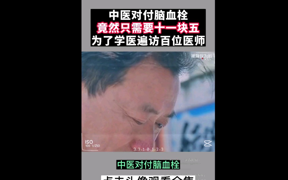 中医对付脑血栓只需十一块五,为学医方遍百位医师哔哩哔哩bilibili