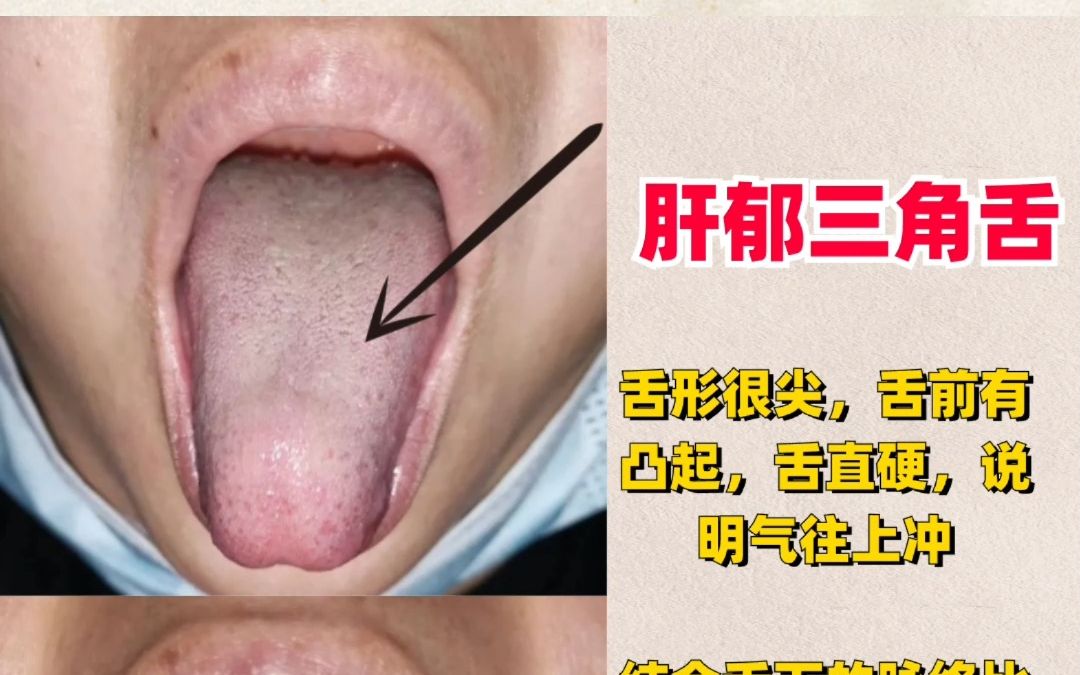 2分钟学会中医舌诊技巧,看病不求人,赶快收藏!