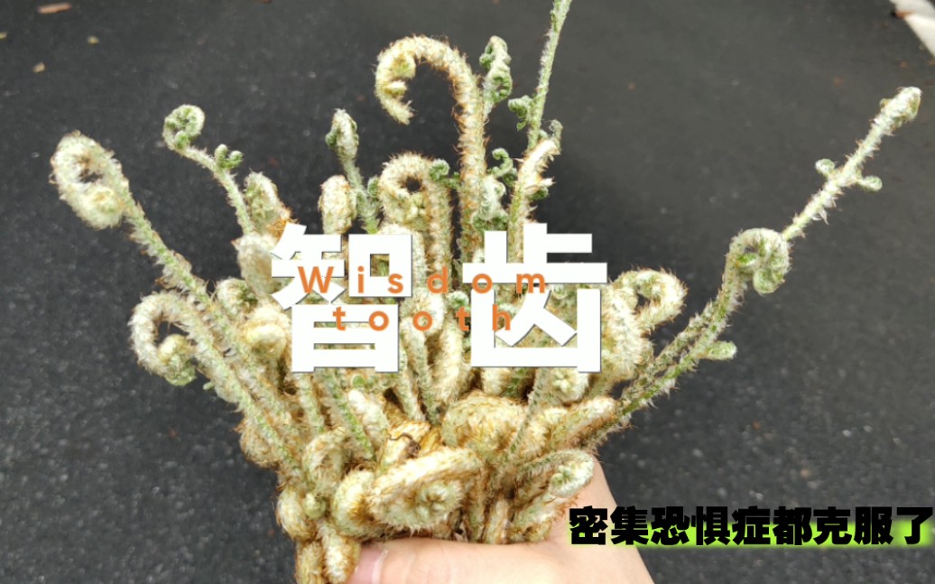 我拔过的智齿集锦,你的智齿在我这吗哔哩哔哩bilibili