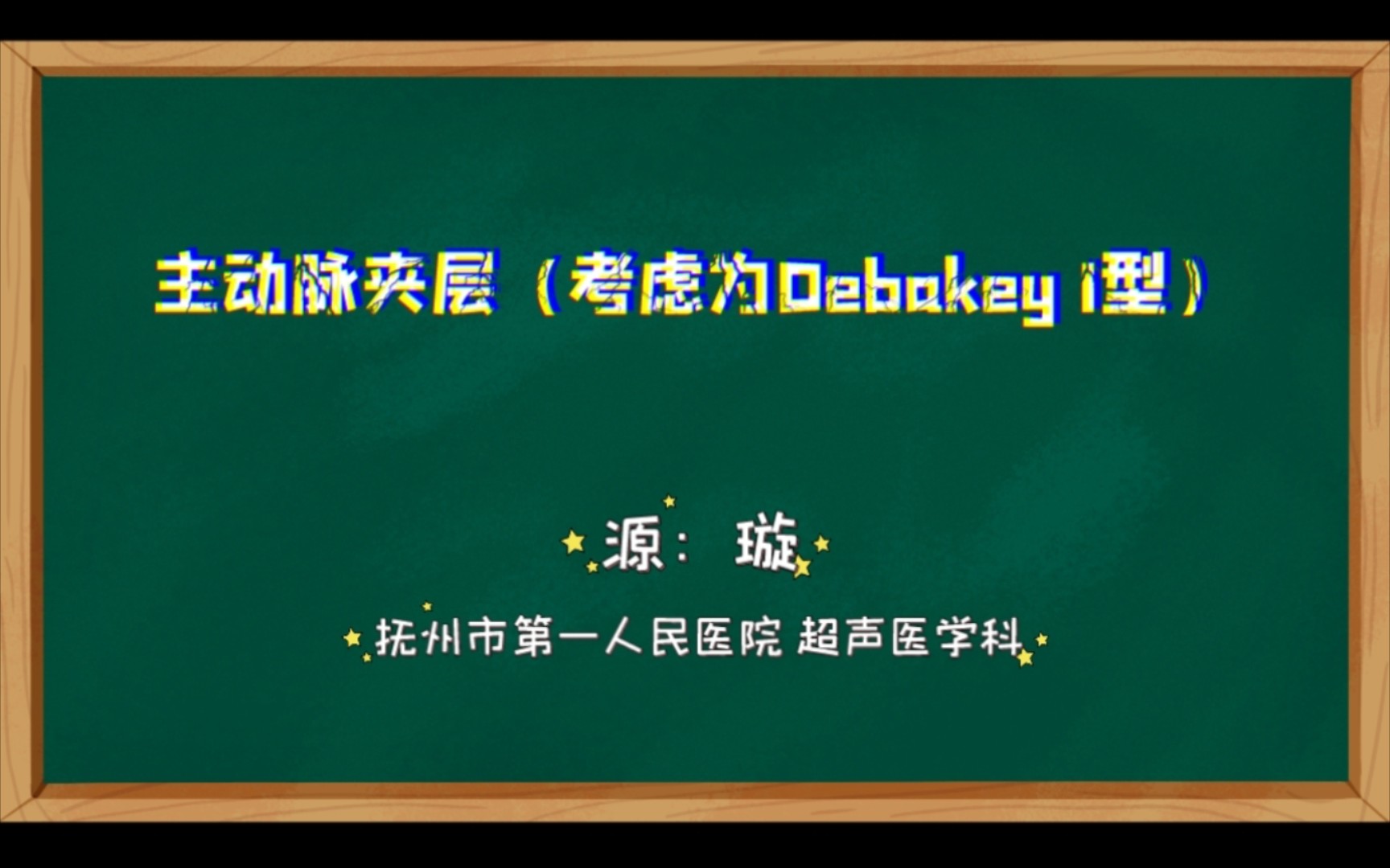 【心超】主动脉夹层(Debakey I型)哔哩哔哩bilibili