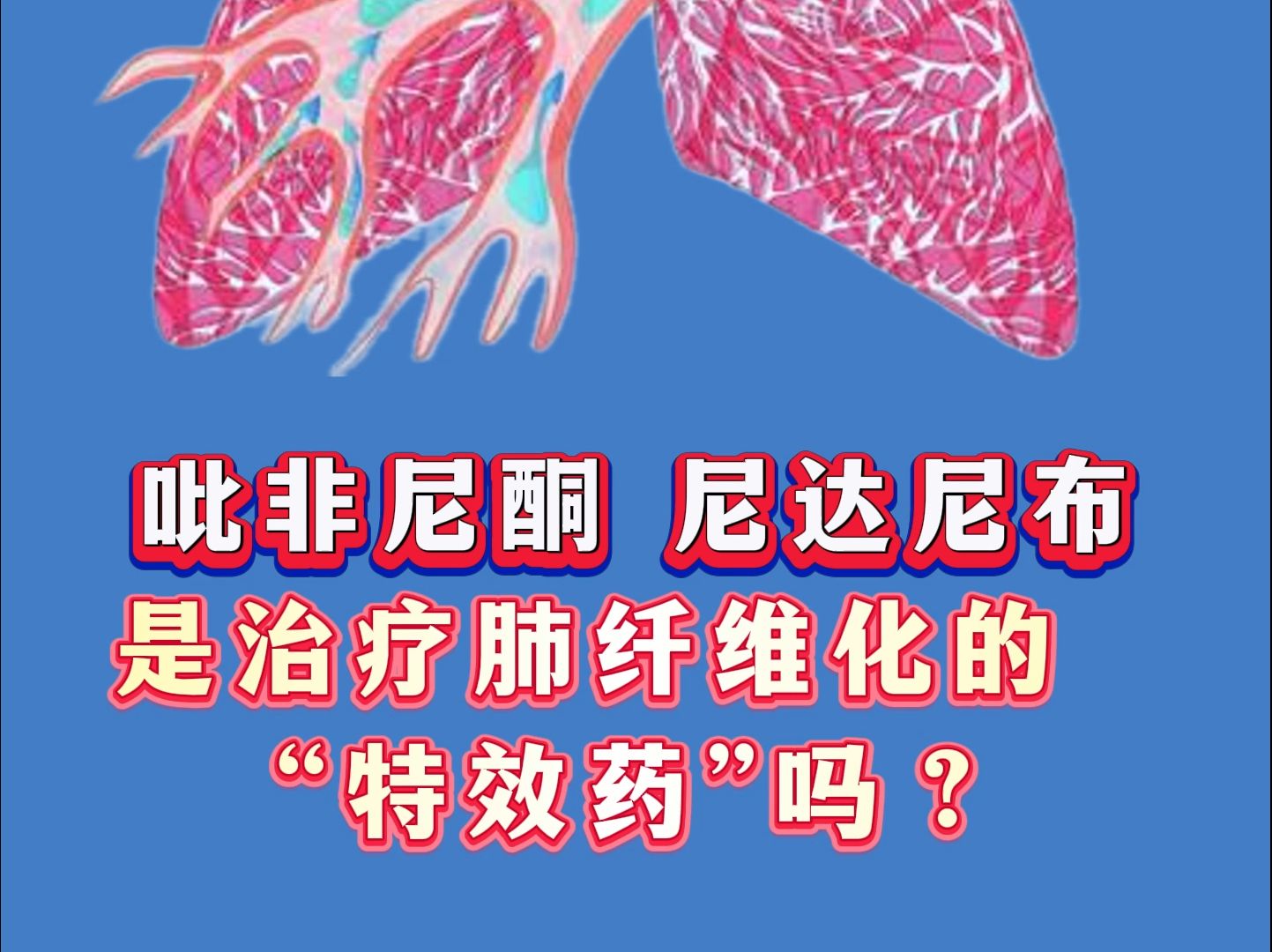 吡非尼酮 尼达尼布 是治疗肺纤维化的 “特效药”吗?哔哩哔哩bilibili