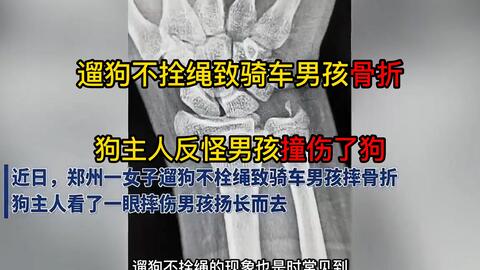 女子遛狗不拴绳致骑车男孩摔骨折 事后女主人身份引众网友热议 哔哩哔哩 女子遛狗不拴绳致骑车男孩摔骨折 事后女主人身份引众网友热议 哔哩哔哩