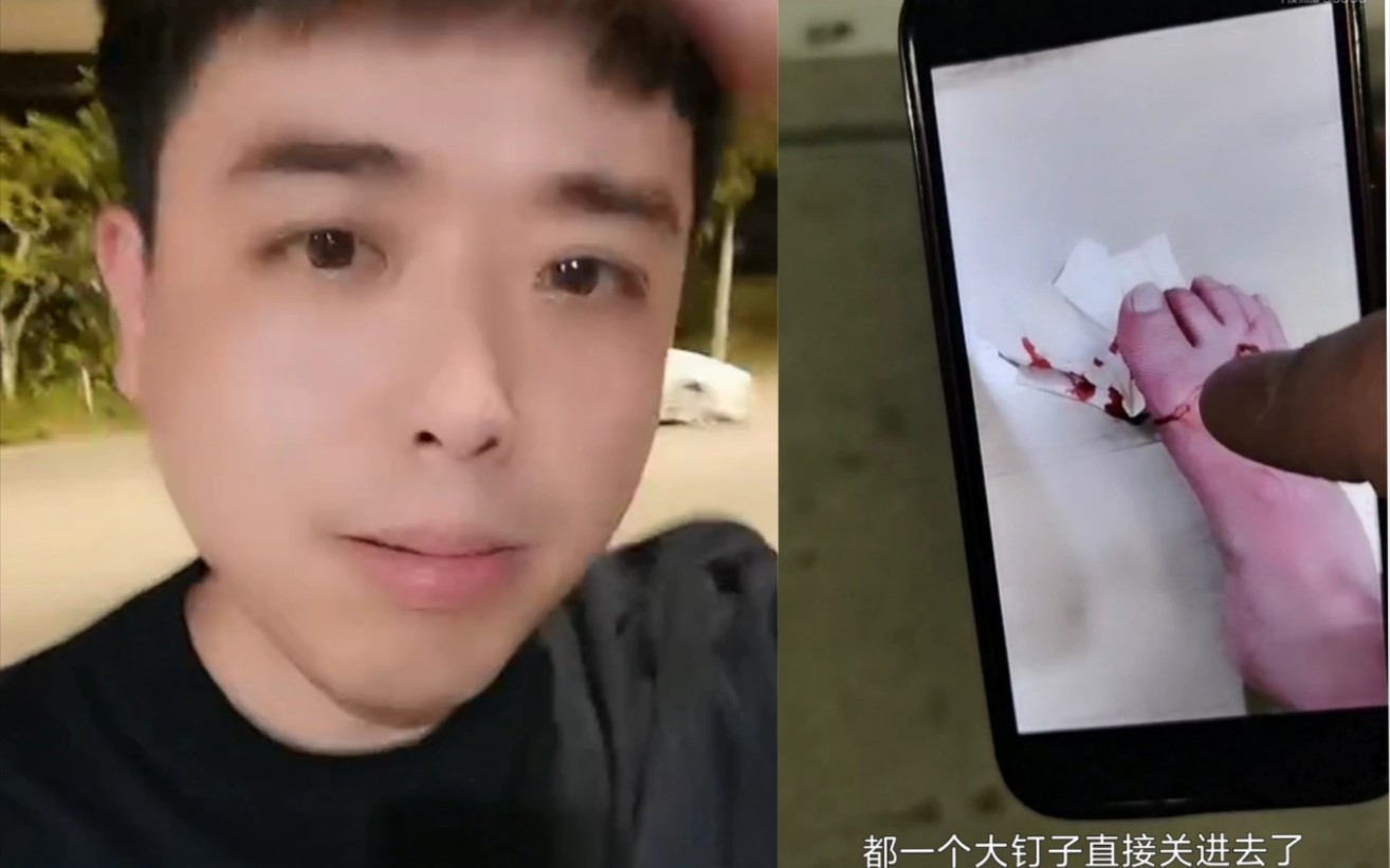 户外探险小龙泰国行第一天受伤,翻译建议小龙雇保镖