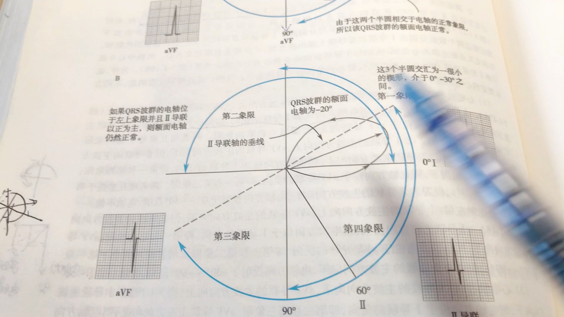 电轴左偏右偏?怎么看?哔哩哔哩bilibili