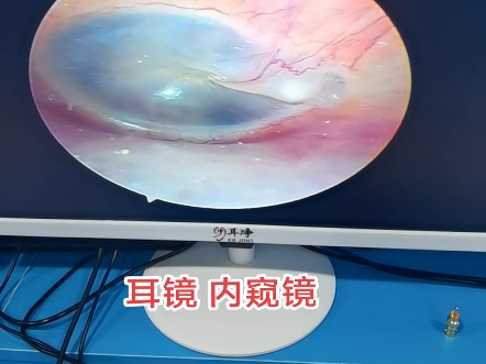 耳镜内窥镜采耳工具套装高清可视采耳仪器