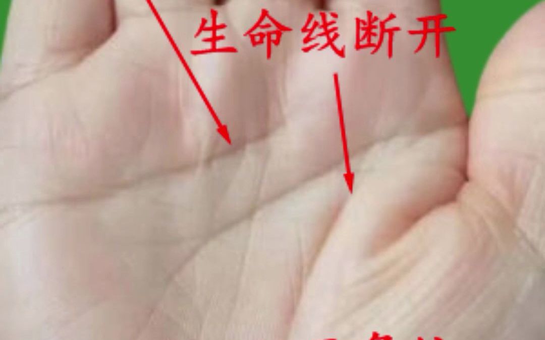 手相生命线出现2个三角