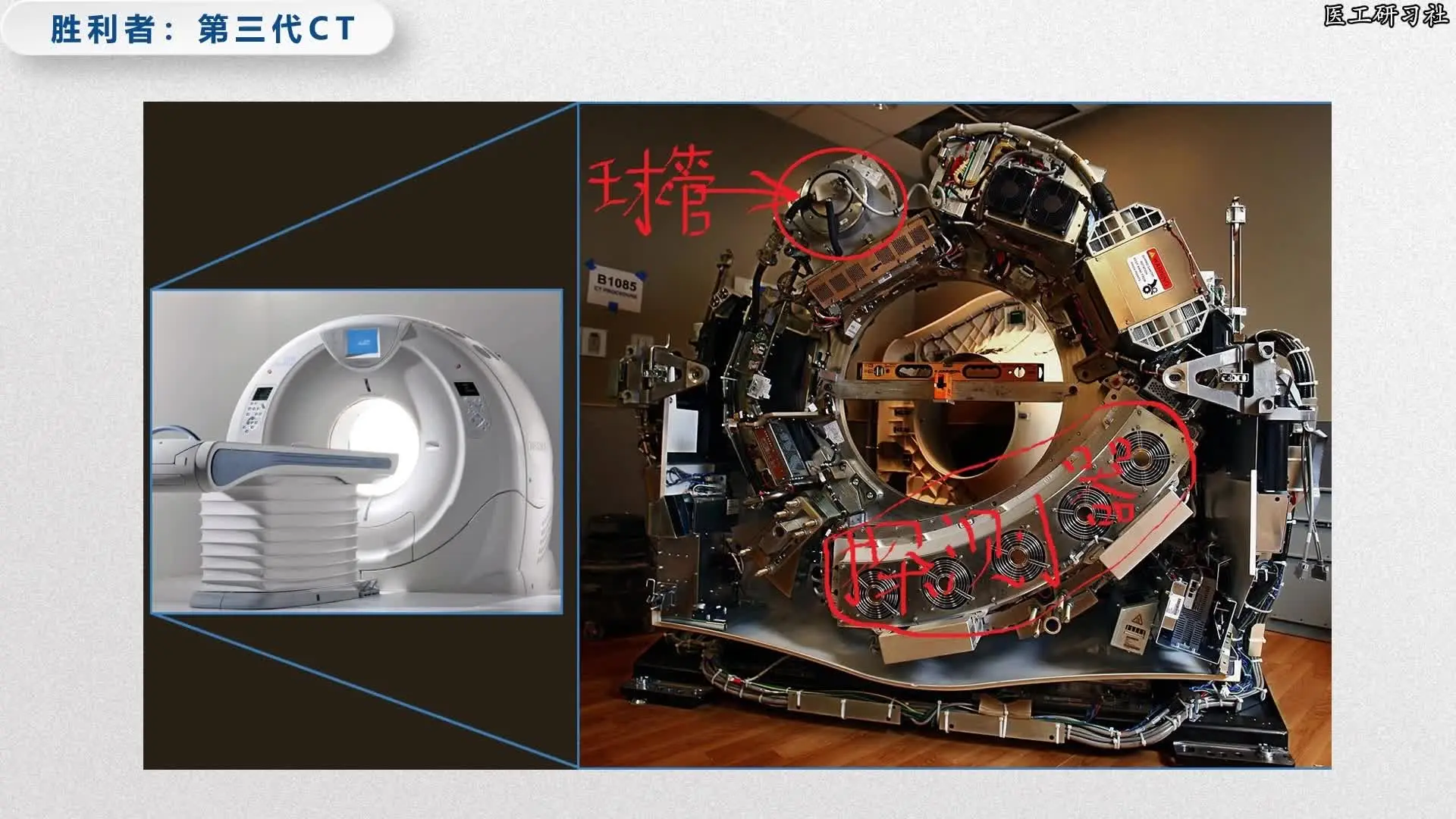 全球CT技术变迁史(中):从“螺旋CT”到“能谱CT”_哔哩哔哩_bilibili