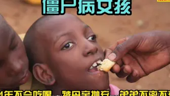 非洲纪录片：僵尸病女孩不会吃喝，被母亲抛弃，弟弟悉心照顾14年