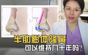 Download Video: 资深整形医生科普：半肋膨体隆鼻可以维持几十年吗？