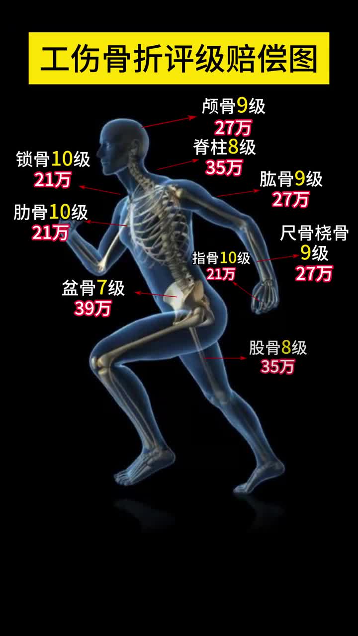 工伤骨折赔偿图来了哔哩哔哩bilibili