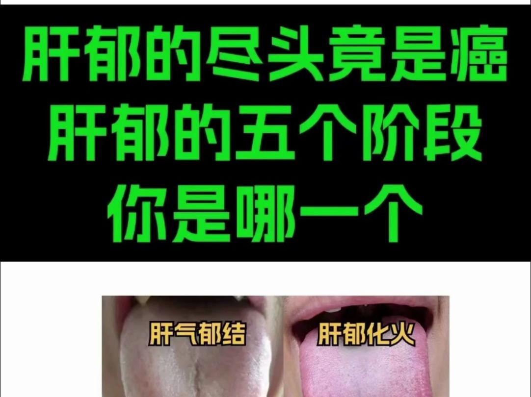 肝郁的尽头竟是癌?肝郁的五个阶段,你是哪一个?哔哩哔哩bilibili