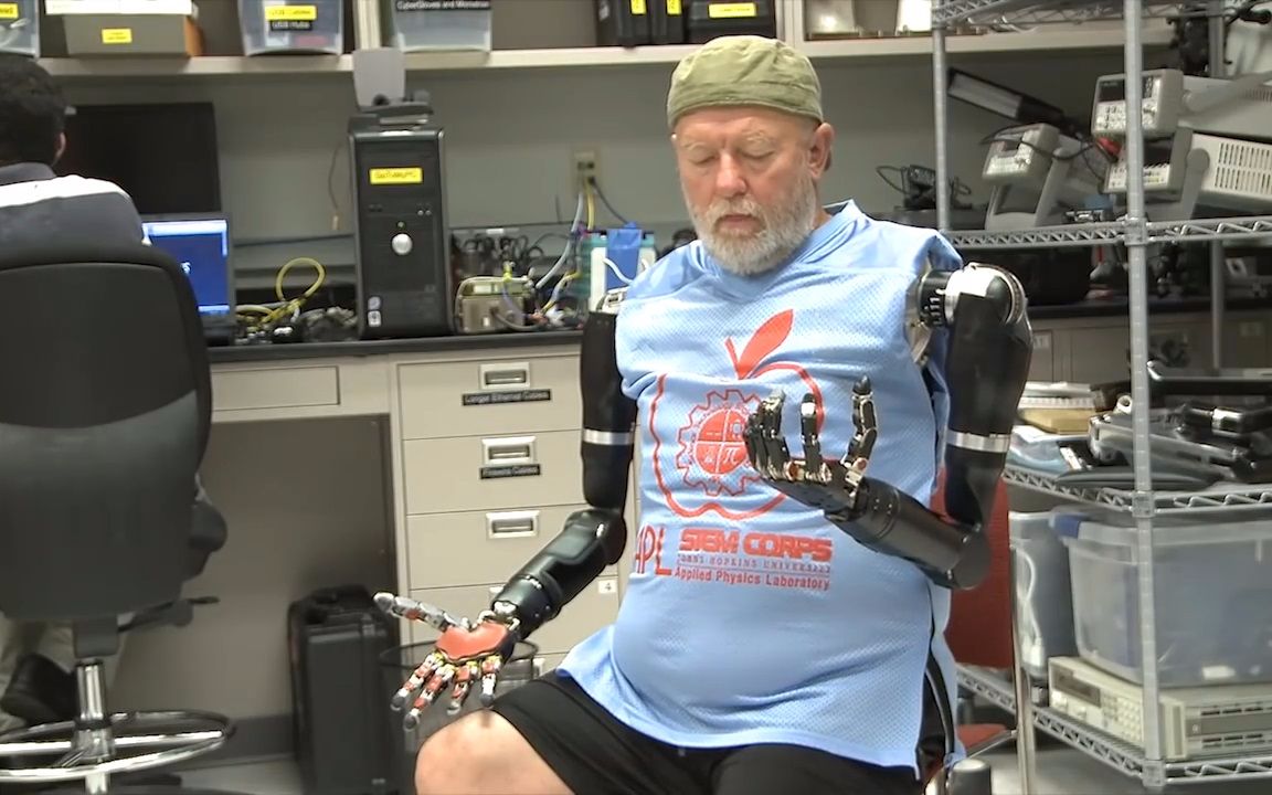 双臂"失而复得",意念假肢,还残疾人自由