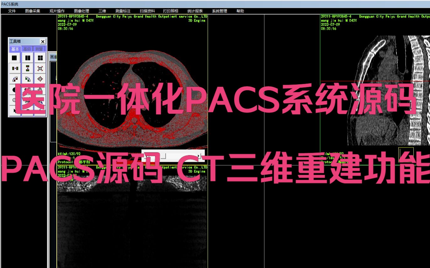 医院一体化PACS系统源码 PACS源码 CT三维重建功能哔哩哔哩bilibili