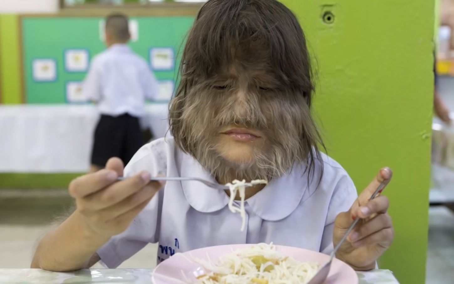 世界毛发最长的女孩,全身长满毛发,剃光后的样子惊艳众人!