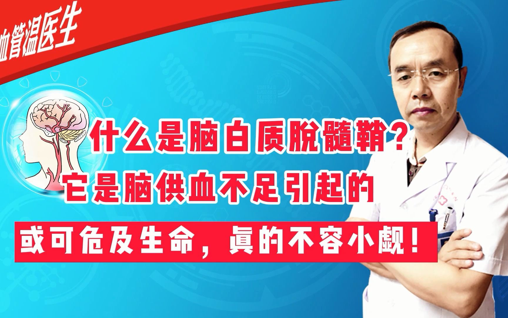 严重的脑白质脱髓鞘改变,或可危及生命,真的不容小觑!哔哩哔哩bilibili