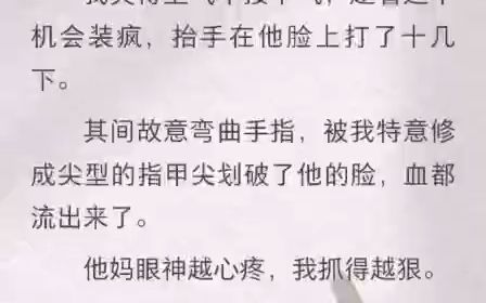 五十大寿那天,我签订了遗产继承协议.把名下所有财产都给了独子.第二天,我就被前夫从二楼推了下去终生瘫痪.面对调查,儿子站在前夫这一边.他以...