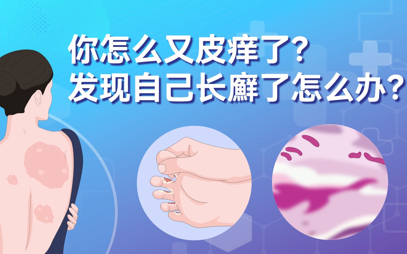 [图]你怎么又皮痒了？发现自己长廯了怎么办？