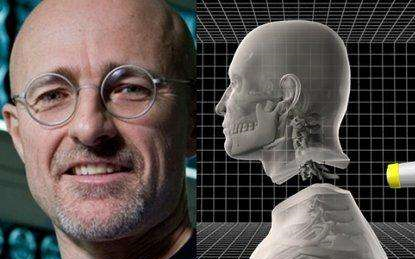 yuri搬运世界上首例人体换头术在中国哈尔滨完成可喜可贺