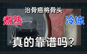 Download Video: 把骨头煮熟或冷冻后再回植身体：这样治骨癌，靠谱吗？