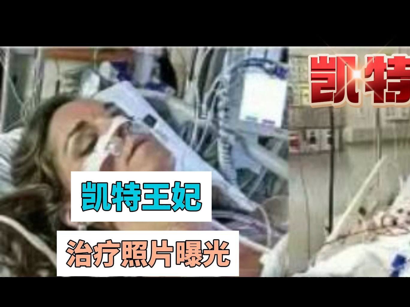 凯特入院治疗的照片曝光!出镜的王妃是本人吗哔哩哔哩bilibili