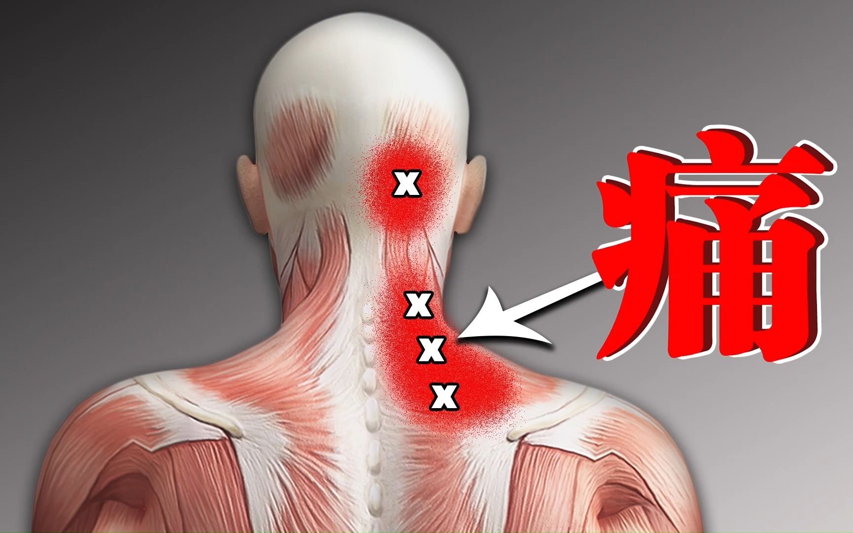 脖子经常酸痛,尝试这4个动作,做完马上缓解-bili_13870807626-运动