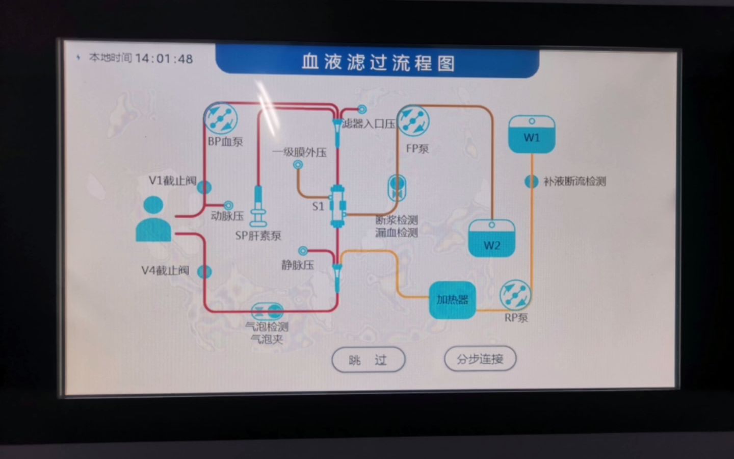 4、DX10血液净化机持续血液滤过治疗物品准备哔哩哔哩bilibili