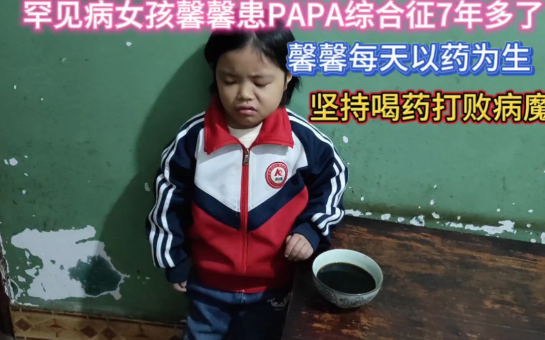 中国第一例世界罕见病PAPA综合征馨馨,天天吃药打针,心疼馨馨哔哩哔哩bilibili